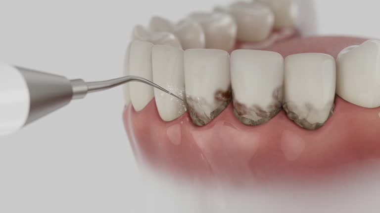 Reliable Dental contractor in Clarks Green, PA by Dentist Open Now
